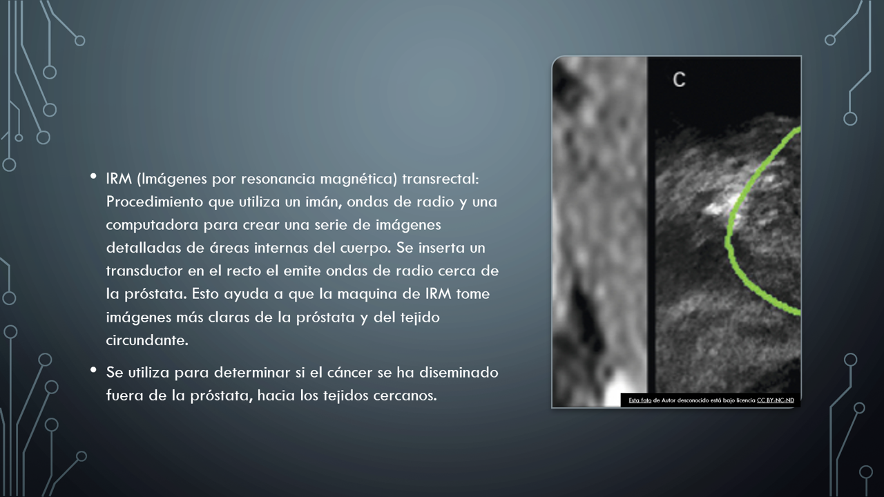 tamaño de la prostata en cc