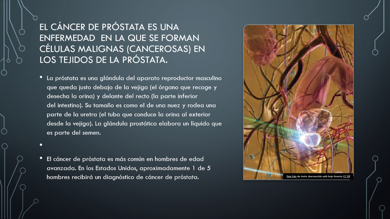 cancer de prostata a que edad se presenta